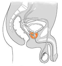 Prostata Abbildung